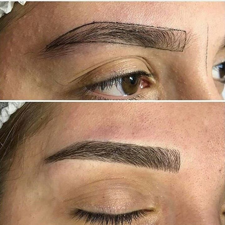 میکروبلیدینگ ابرو