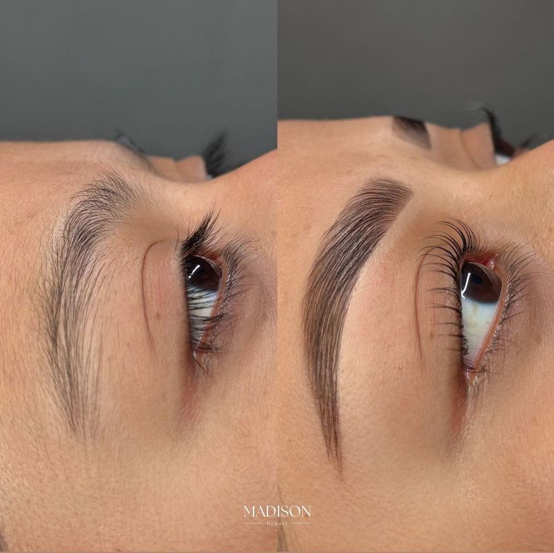 میکروبلیدینگ ابرو