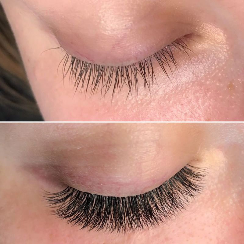 کاشت مژه موقت