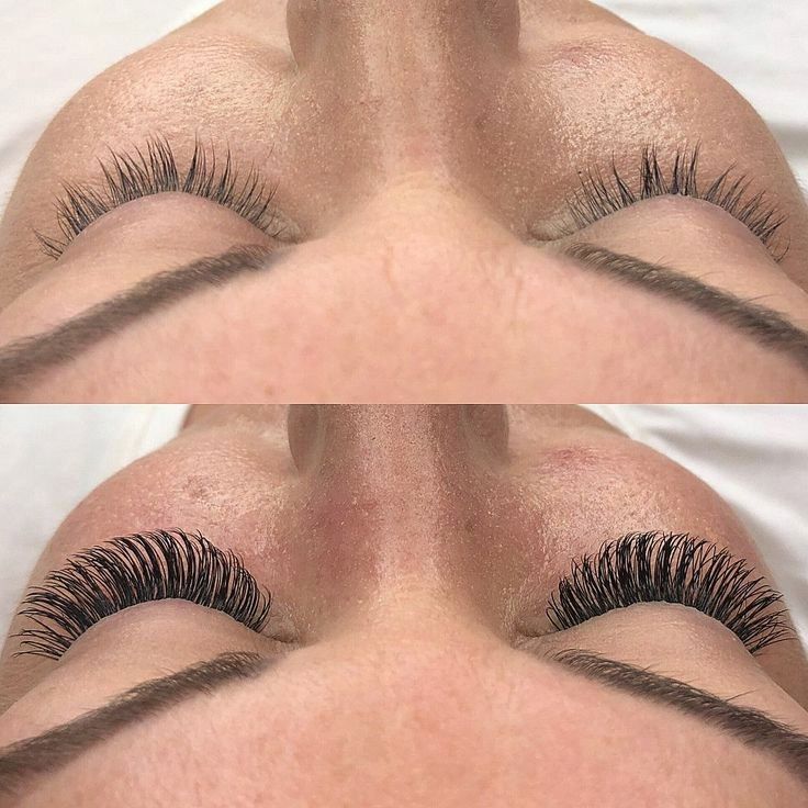 کاشت مژه موقت